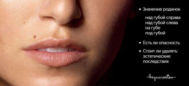 Родинка на губе