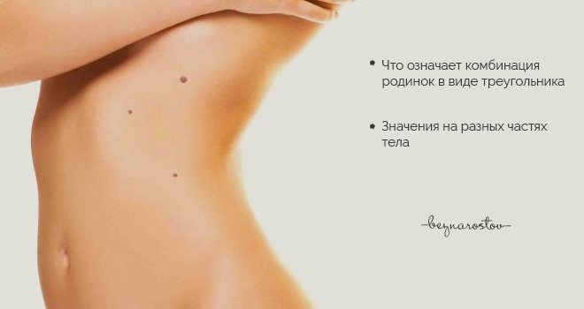 Треугольник родинок