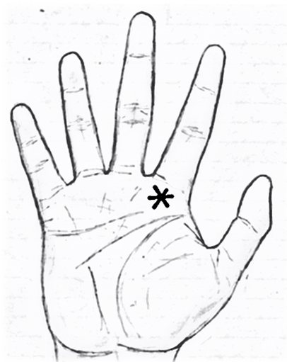 Звезда на холме Юпитера